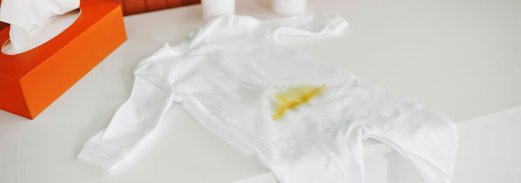 How to Get Poop Stains Out of Baby Clothes: Quick Fixes